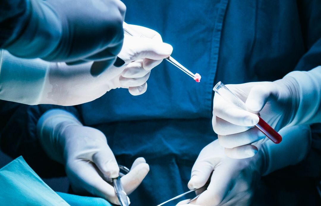 surgical specimen container in operating room