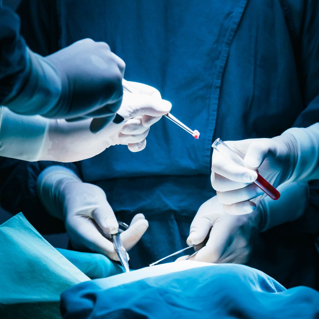 surgical specimen container in operating room