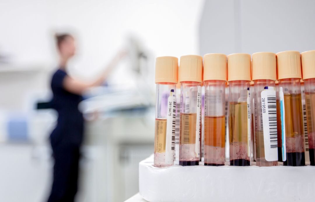 hospital pathology lab specimen processing